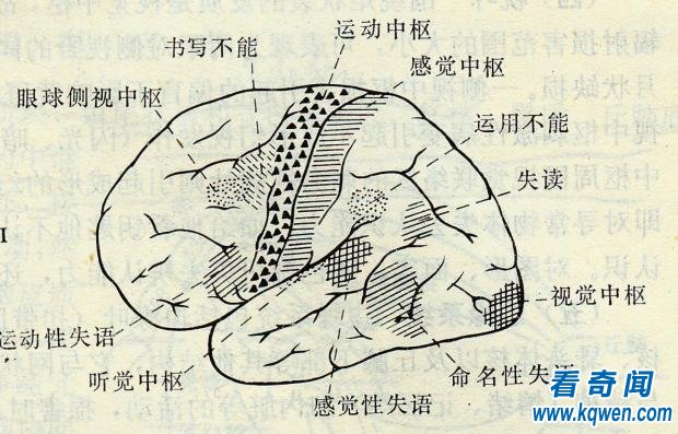 探索大脑未解之谜，智商高的人更容易做梦？