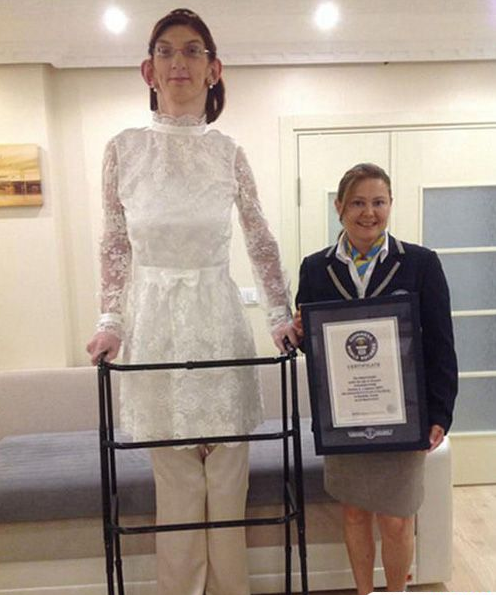 土耳其十七岁美少女怪人以2.126净身高获得世界吉尼斯少年身高纪录