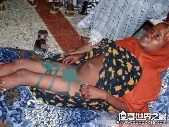 非洲的女性割礼是什么意思呢，破坏女性敏感部位(残忍至极)