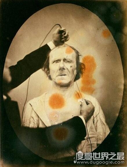 达尔文最后的恐怖实验，用电流刺激面部肌肉做表情堪比酷刑
