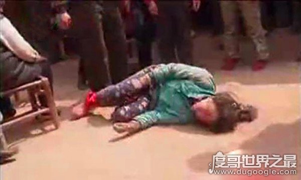 13岁蛇女真相，疑似发烧导致精神障碍(后被乡间神医救治)