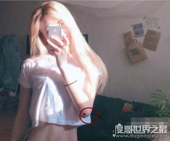 女人身上的十大凶痣，女人身上十大凶痣图片解析(一定要点掉)