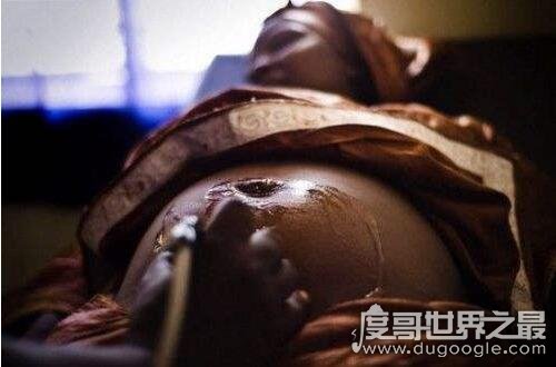 降低性欲的非洲女性割礼，竟是男人对性欲的需求