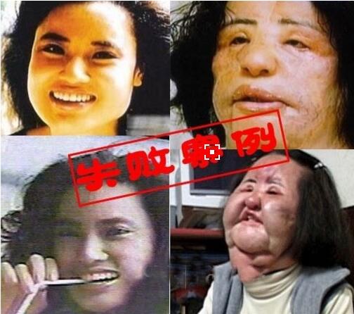 韩国风扇大妈韩苗可，整容被整成风扇脸(整容前后对比照)