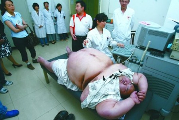 中国第一胖梁用减肥160斤，而孙亮真的是被胖死的