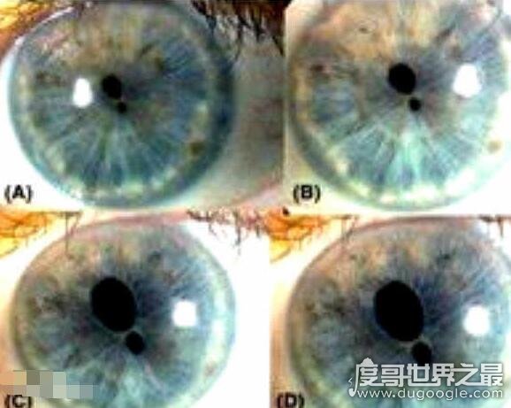 世界上最恐怖的眼睛，双瞳孔人在古代是吉利和帝王的象征