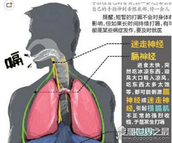 世界上打嗝时间最长的人，查尔斯·奥斯本(连续打嗝68年)