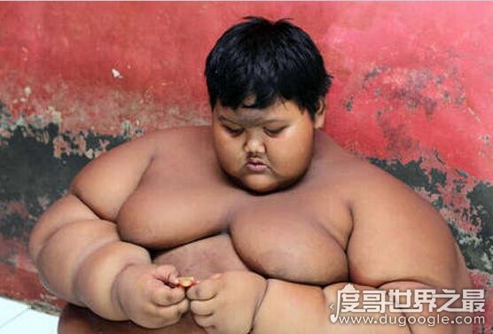 世界上最胖的孩子，阿里亚·珀尔马纳(仅10岁重400斤)