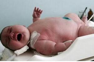 世界上最大的婴儿，重达36斤(最小的婴儿竟只有280克)