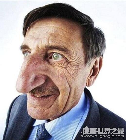 世界上鼻子最大的人，最长的应该是14厘米(世界纪录是8.8)