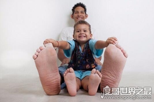 世界上脚最大的人，脚长度达40.5厘米(要穿72码的鞋)