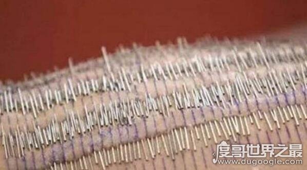 世界上人体穿刺最多的人，史泰莎·兰德尔(插3200枚钢针)