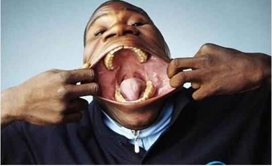 世界第一大嘴男，嘴巴长达17厘米(能吞208只筷子)