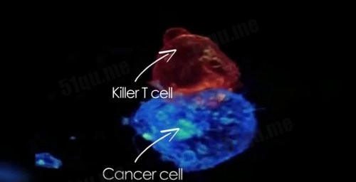 人体内有能够杀死癌细胞的东西