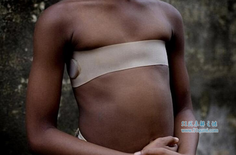 非洲最恐怖的习俗割礼 少女迫害根源