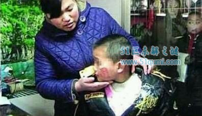 注射器扎幼儿屁股 近些年震惊中国的幼儿园虐童事件