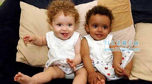 世界上最奇特的十大双胞胎 罕见的黑白配双胞胎!