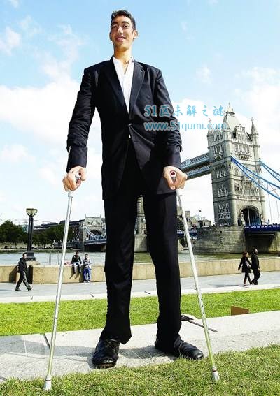 世界第一高人是谁?苏尔坦·科森身高2.47米创世界纪录