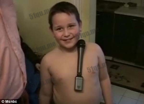 塞尔维亚男孩拥有超能力胸口可吸各种物品