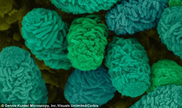 图为一组葡萄穗霉孢子在显微镜下的样子