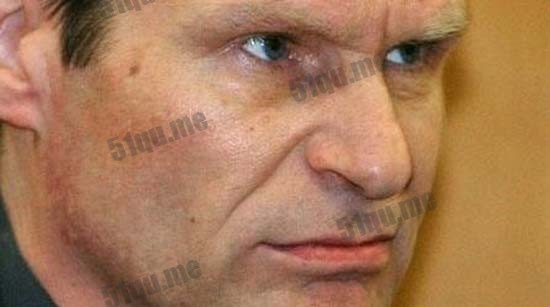 阿明-迈维斯（Armin Meiwes）