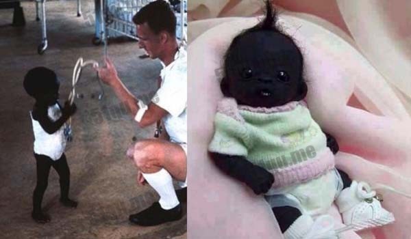 世界上最黑的孩子（baby Really Black）