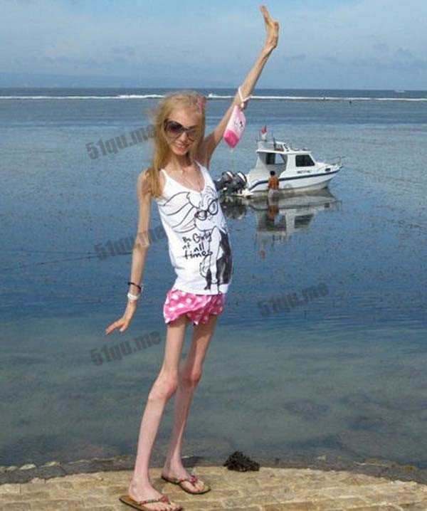 世界上最瘦的女人 Kseniya Bubenko