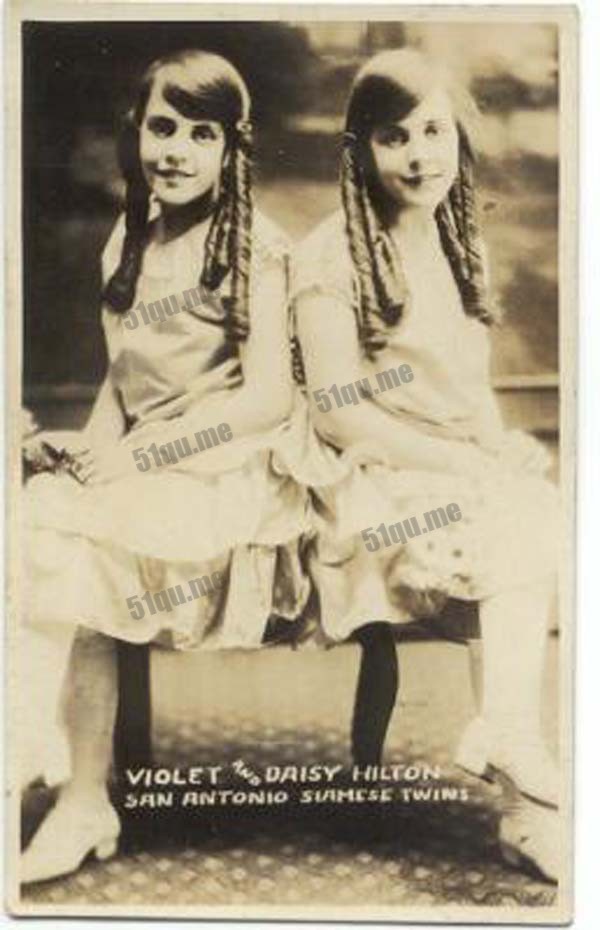 英国姐妹Daisy和Violet Hilton