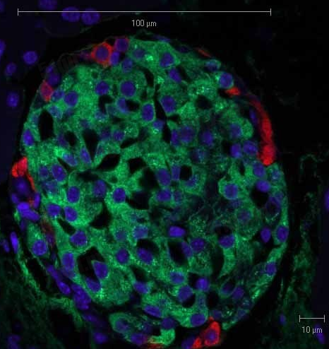 人皮细胞已经可以制造出胰岛素的细胞