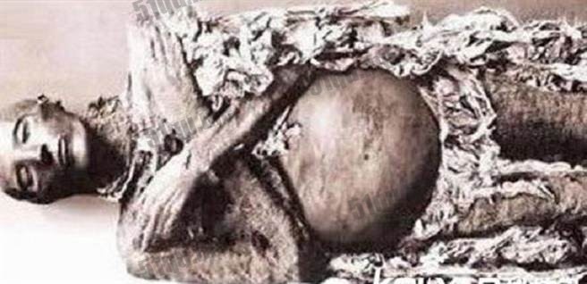 冰冻古尸600年后依然产下男婴