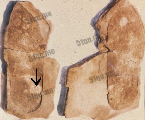 三叶虫化石上的"便鞋脚印"