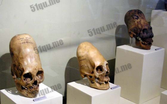 Paracas skull