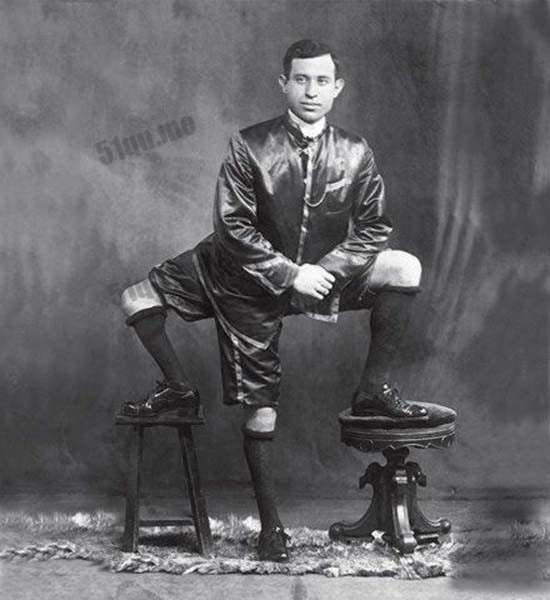 三条腿的男人francesco lentini